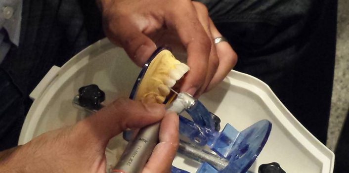 Smile Design & Veneer preparation course in action